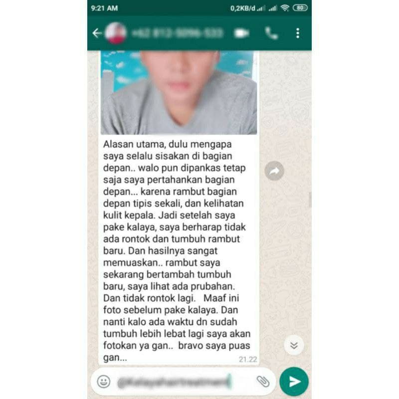 1 Paket Lengkap Kelaya Shampo Serum Minyak Kemiri - Original Asli Ori 100% Obat Rambut Rontok Parah-4
