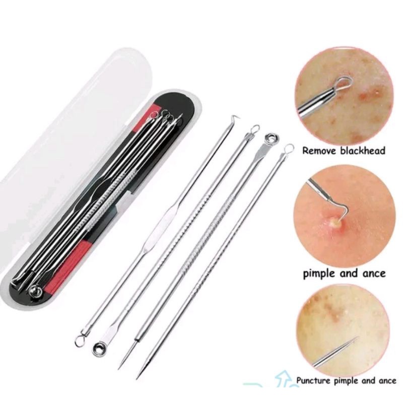 PINSET KOMEDO 4 IN 1 ALAT PENCET JERAWAT PEMBERSIH BLACKHEAD