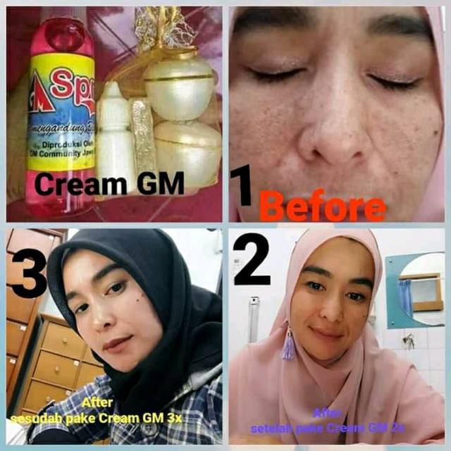 Cream Gm Cream Herbal Cream Paket Cream Pemutih Kecantikan Shopee Indonesia