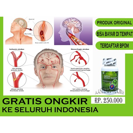 

KAPSUL EKSTAK PEGAGAN| UNTUK MENGATASI PENYUMBATAN DARAH D OTAK - MELANCARKAN PERDARAN DARAH DI OTAK