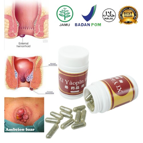 Obat Wasir Original Obat Ambeien Tanpa Operasi XI YAOPIN ZHI