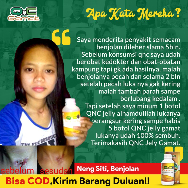 Obat Luka Sunat Bengkak Bernanah Luka Khitan Cepat Kering Shopee Indonesia