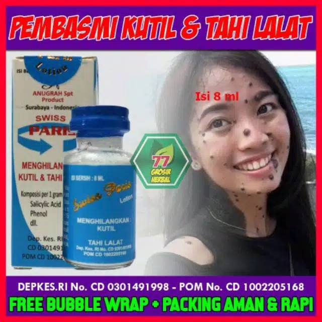 OBAT TAHI LALAT DAN KUTIL TANPA OPERASI AMAN ORIGINAL BPOM