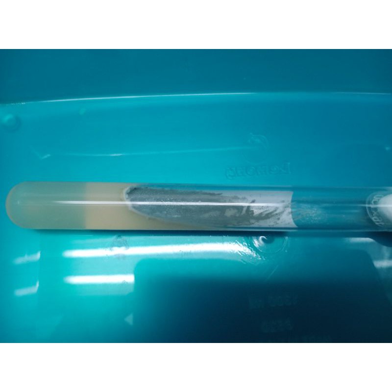 

Aspergillus fumigatus