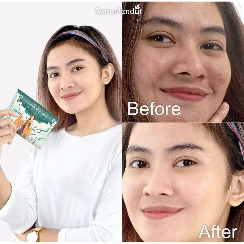 MASKER LULUR  RORO MENDUT SKINCARE BPOM ANTI ACNE ANTI AGING PEMUTIH SELANGKANGAN BOKONG KETIAK