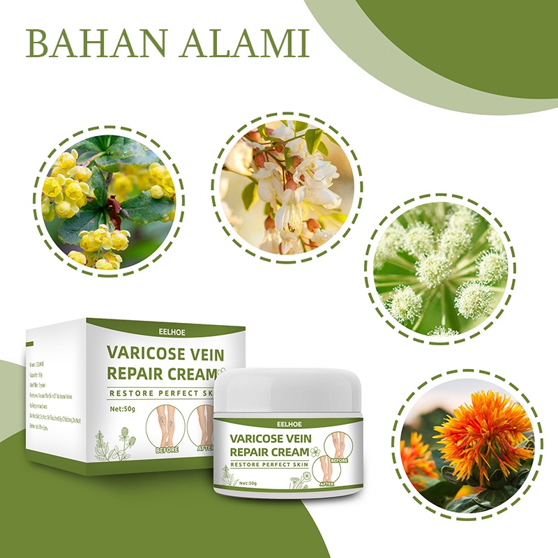 Terlaris !!! Varicose Veins Obat Varises Varikokel Bengkak Benjolan Buah Zakar Nyeri Testis Paling Ampuh Varicose Veins Treatment Cream/Obat Krim Varises Parises Tanpa Operasi