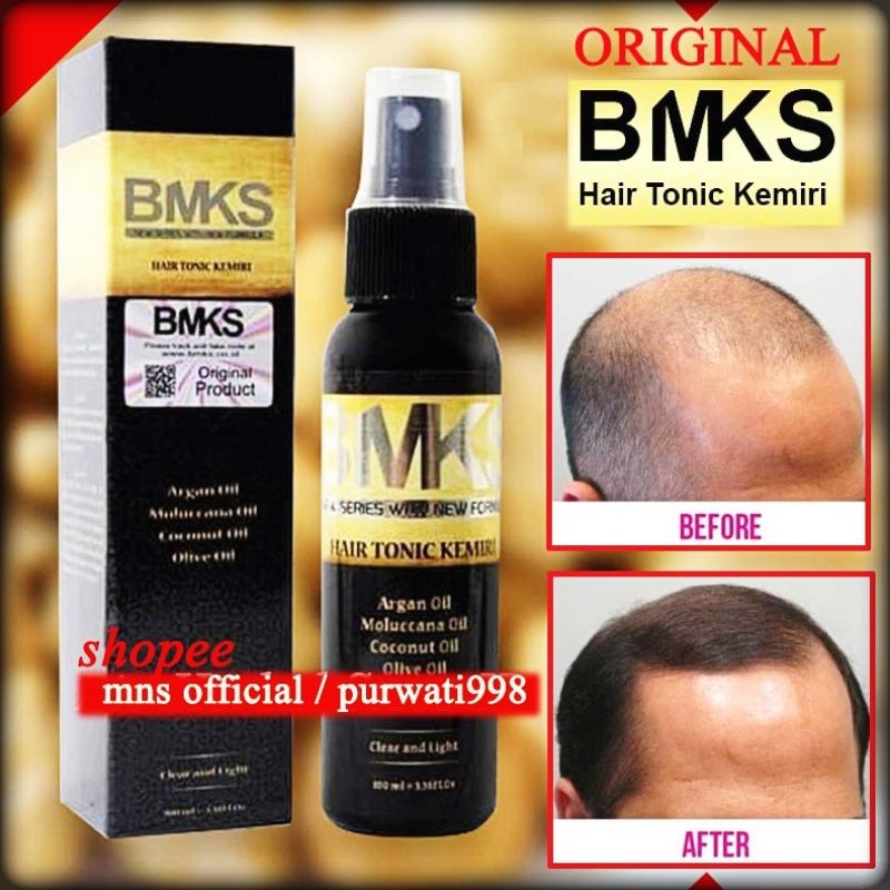 HAIR TONIC KEMIRI BMKS 100 ML TONIK KESEHATAN RAMBUT, MENYUBURKAN, MENEBALKAN, MENGUATKAN