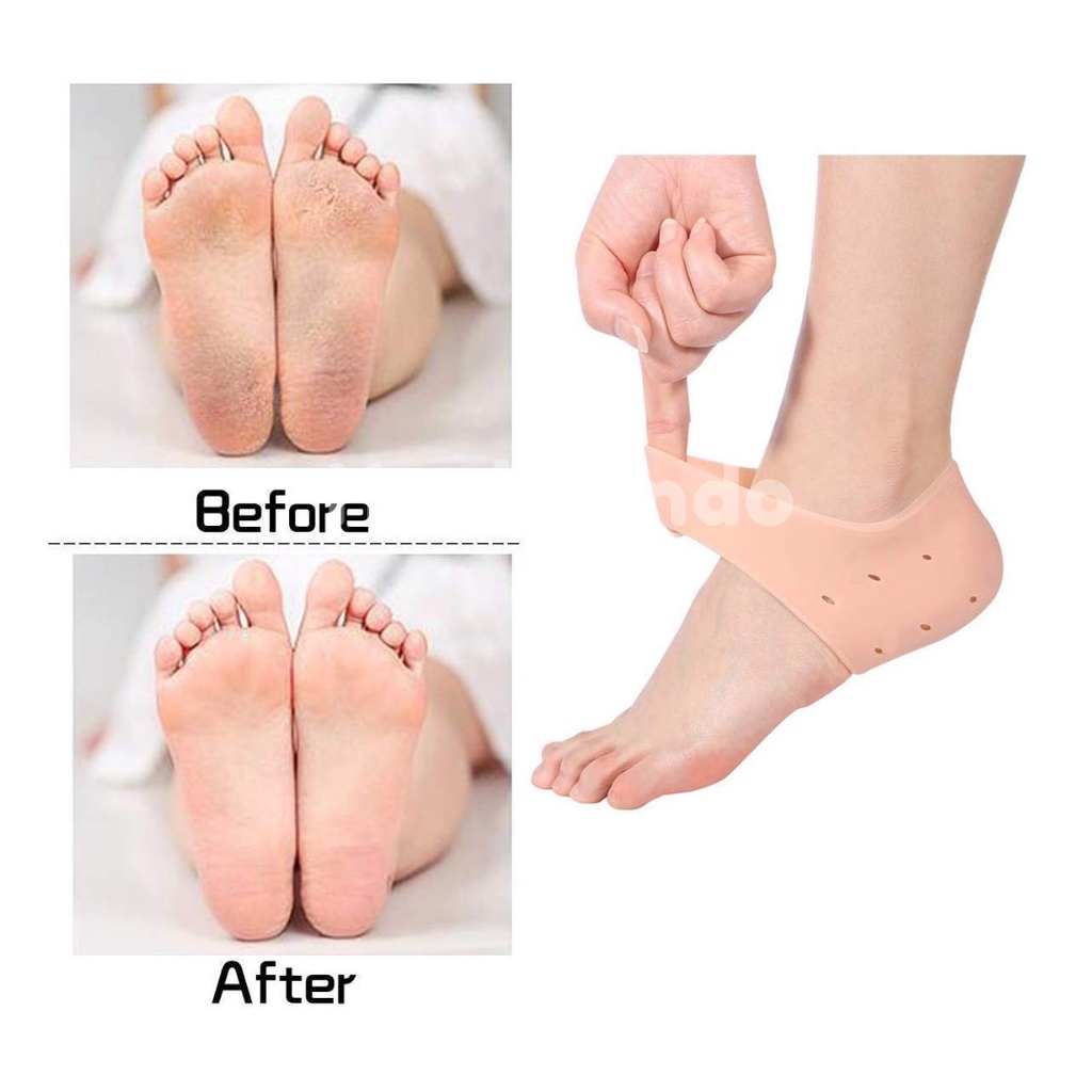 Healthindo - Pelindung Tumit Kaki Silikon Tumit Kaki Moisturizing Kaki Pencegah Kapalan Silicone Heel Protector