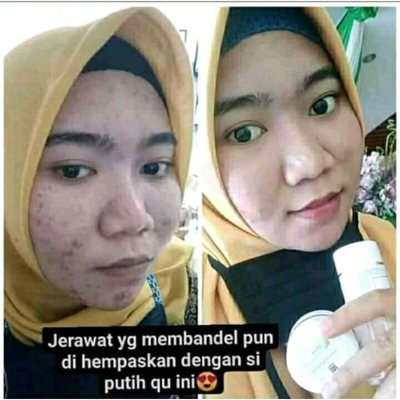 MH WHITENING SKIN