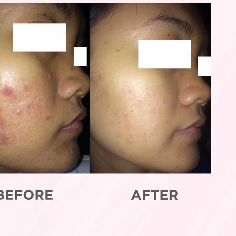 ◌ Airnderm Aesthetic Niacinamide Gel (by AIRIN BEAUTY) ♞