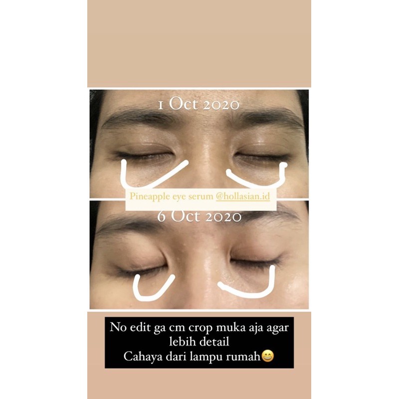 hello derma eye serum