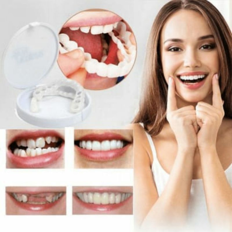 Gigi Palsu Atas Bawah Instan Gigi Palsu Silikon Alami Snap On Smile Putih 100% Original Authentic