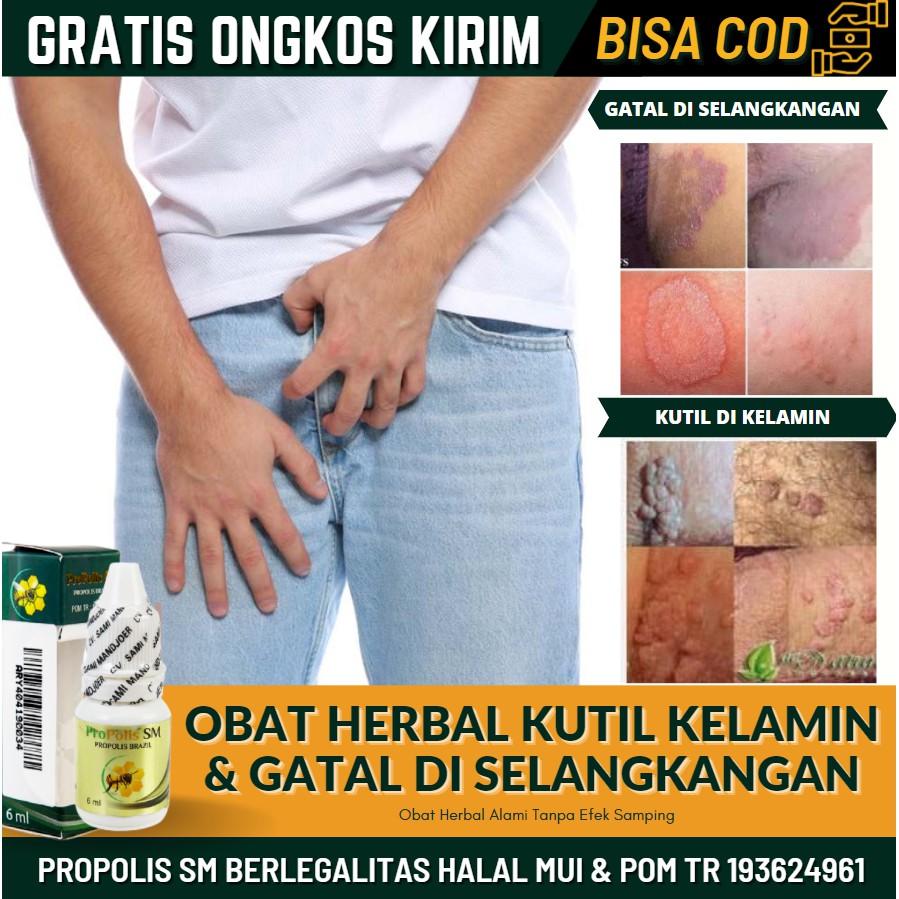 Obat Oles Gatal2 Di Selangkangan & Penghilang Kutil, Perontok Kutil Di Kelamin / Selangkangan Alami
