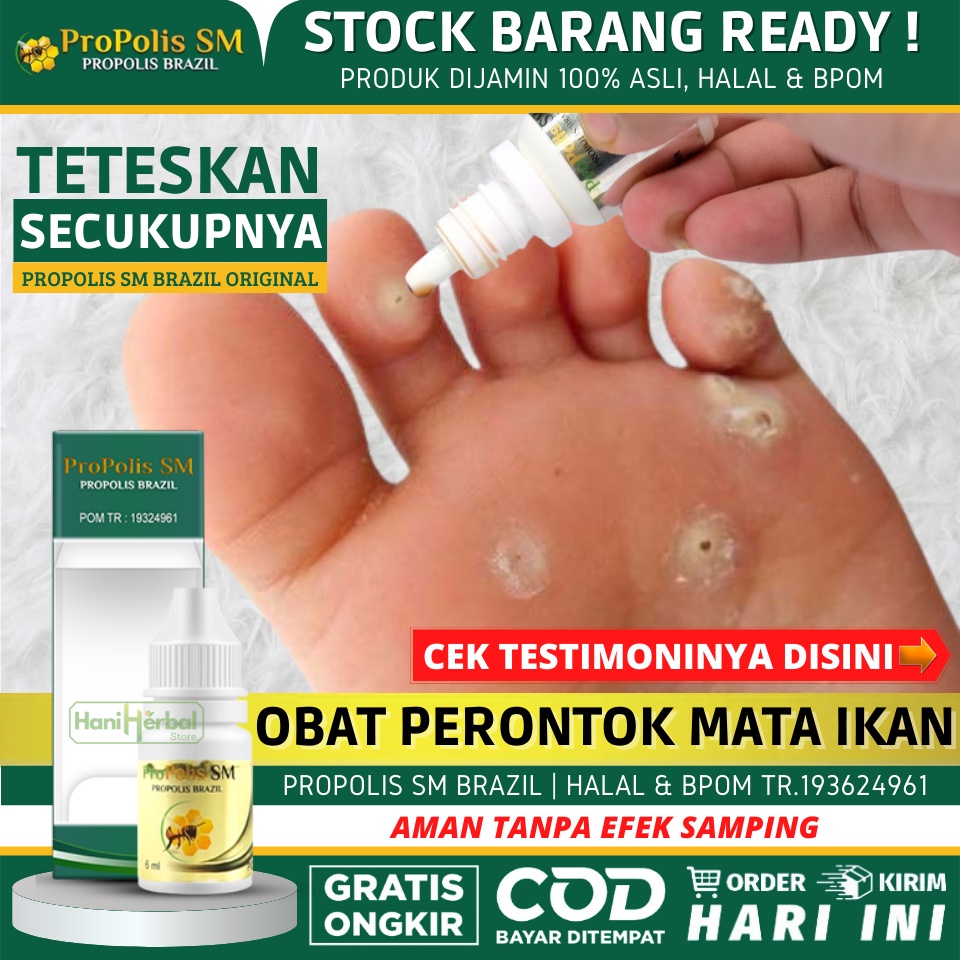Obat Mata Ikan, Obat Perontok Kutil & Mata Ikan, Obat Benjolan di Telapak Kaki, Obat Oles Penghilang