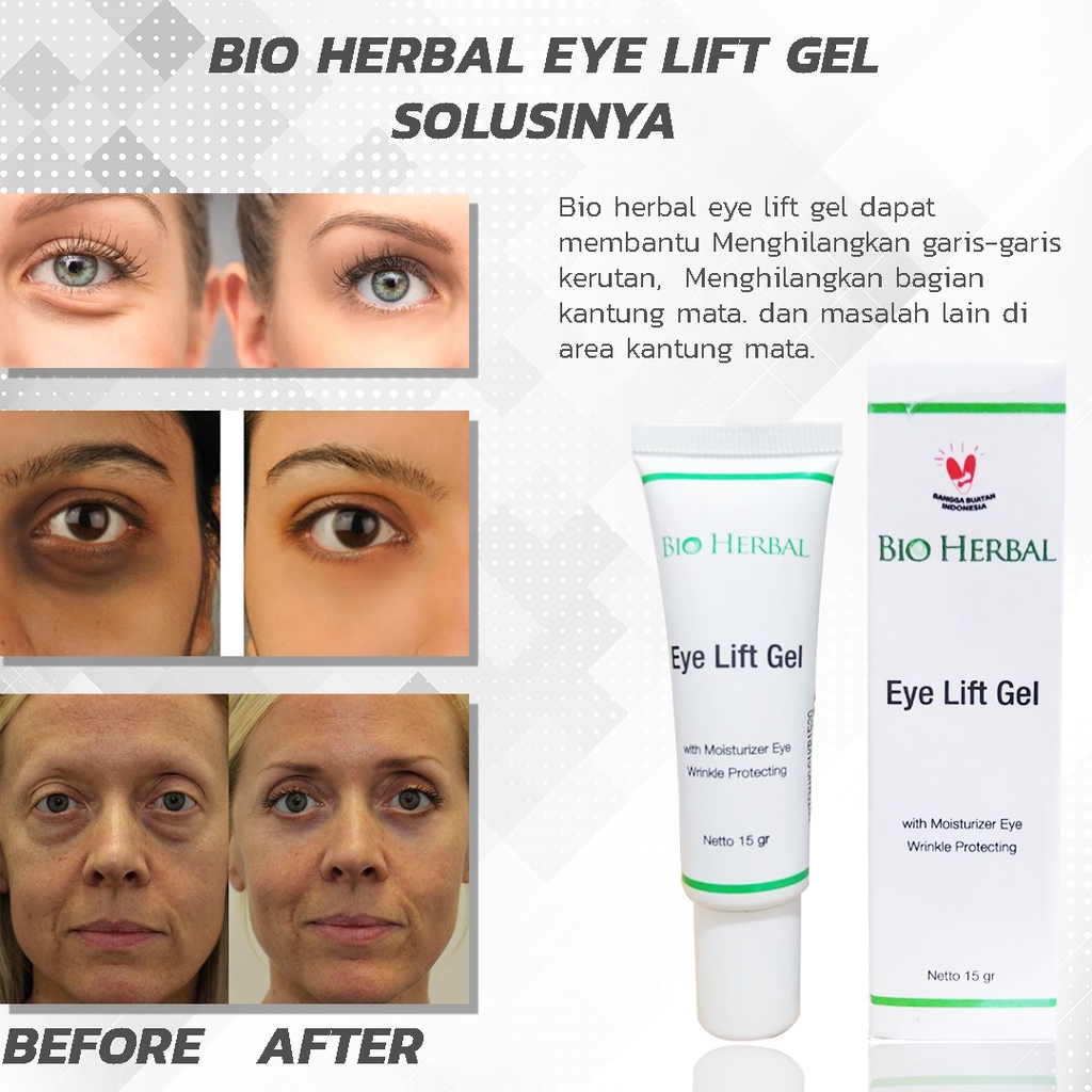 BIO HERBAL EYE LIFT GEL Perawatan Penghilang Kantung Mata PandaEye Lift Cream Gel Herbal Treatment Permanent Wanita dan Pria