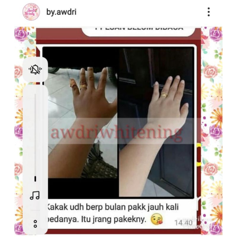 LOTION PEMUTIH BADAN AMPUH HB DOSTING UNTUK KULIT SUSAH PUTIH RACIKAN DOKTER