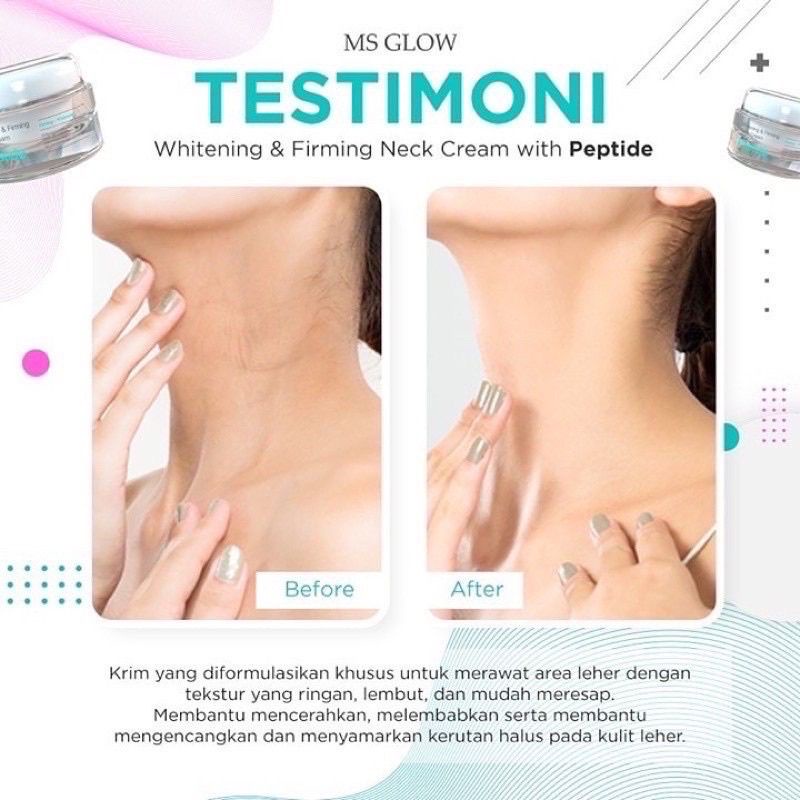 NECK CREAM MS GLOW FREE ROLLER ORIGINAL BISA COD