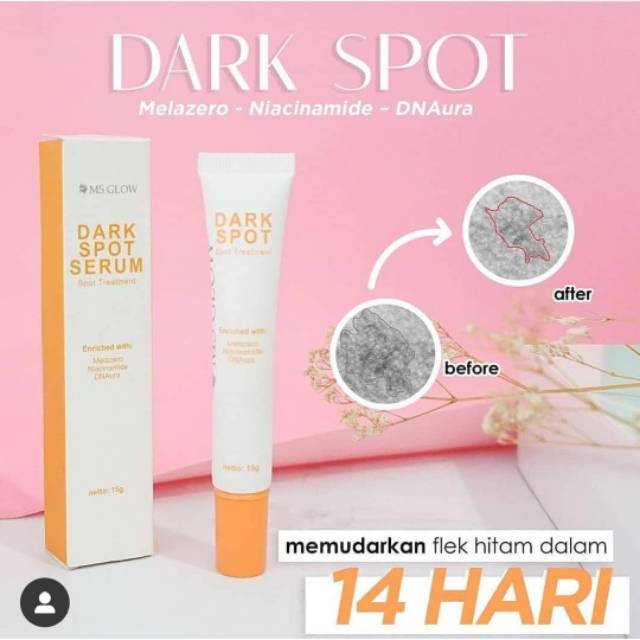 

Dark spot