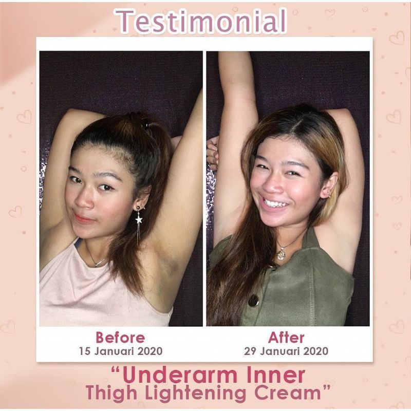 UNDERARM MS GLOW - CREAM PEMUTIH KETIAK DAN BAGIAN LIPATAN