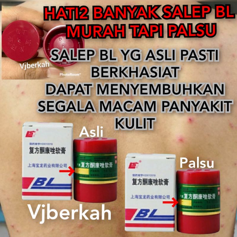 【READY STOK】 Salep BL Original 100% SCRUB untuk gatal shinsei exim panu kadas kurap,