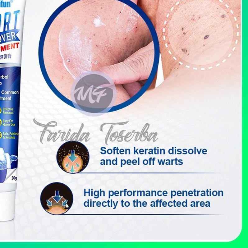 ❃ ORIGINAL Skin Tag Remover SUMIFUN Wart Remover Ointment | Penghilang Tahilalat ♖
