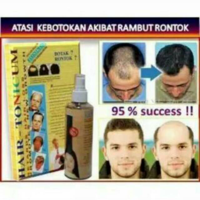 OBAT PENUMBUH RAMBUT BOTAK SERUM PENUMBUH RAMBUT KEPALA