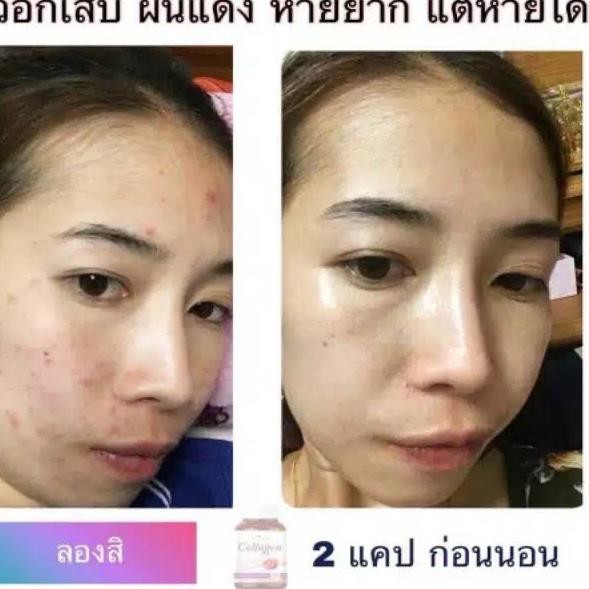 HKL Collarich Collagen colla rich collagen Original Thailand 100% BFG (Terbaru)