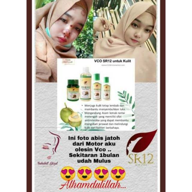Virgin Coconut Oil 60ml SR12 / Minyak kelapa murni  / VCO / VICO SR12 / Penggemuk badan /minyak vico