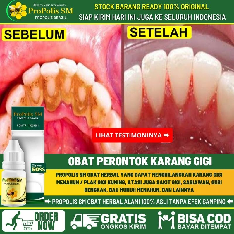 Obat Perontok Karang Gigi, Memutihkan Gigi, Gigi Hitam, Obat Kesehatan Gigi, Obat Sakit Gigi, Obat G