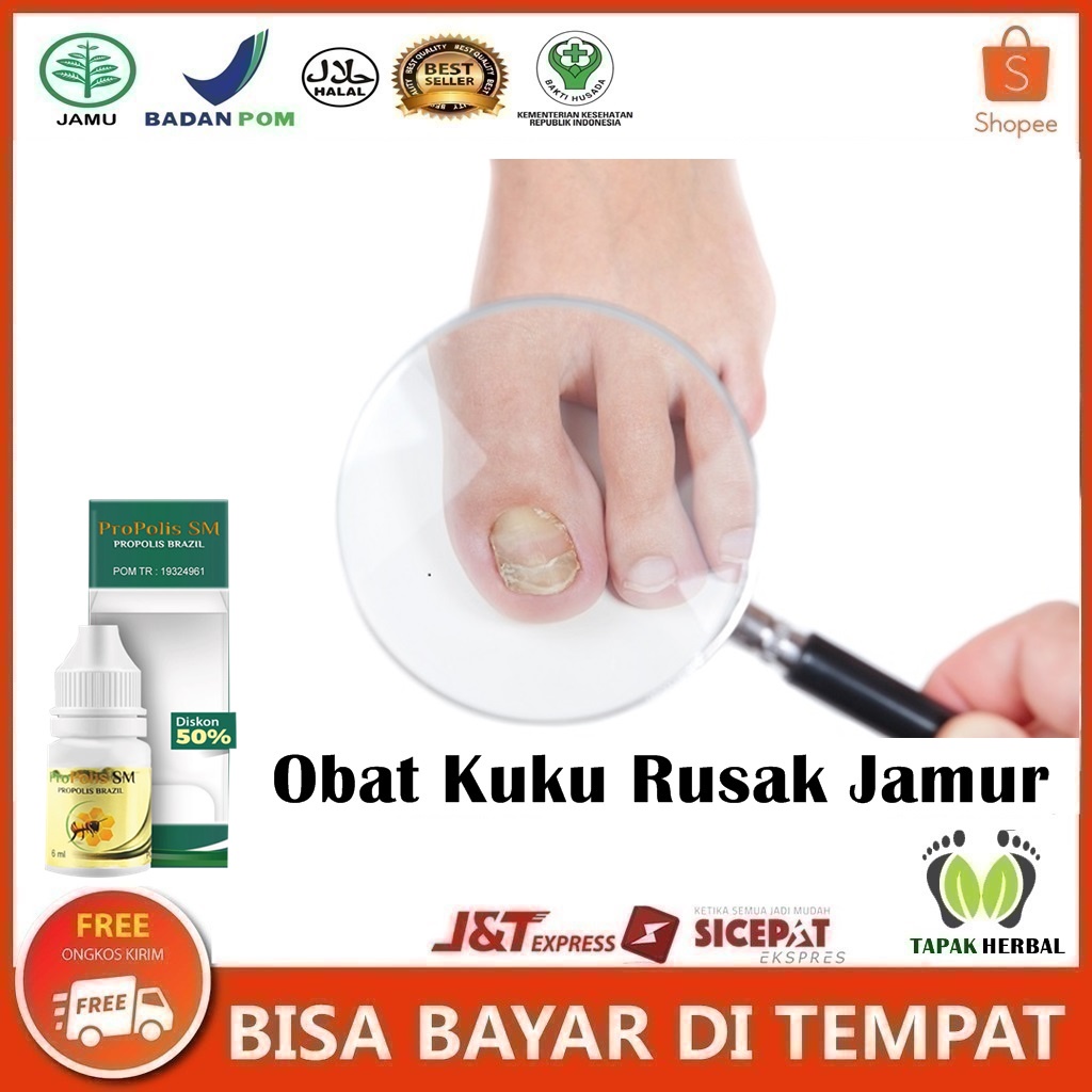 Obat Jamur Kuku Rusak, Obat Infeksi Jamur Kuku, Obat Pembersih Kuku Kuning, Obat Psoriasis Kuku, Oba