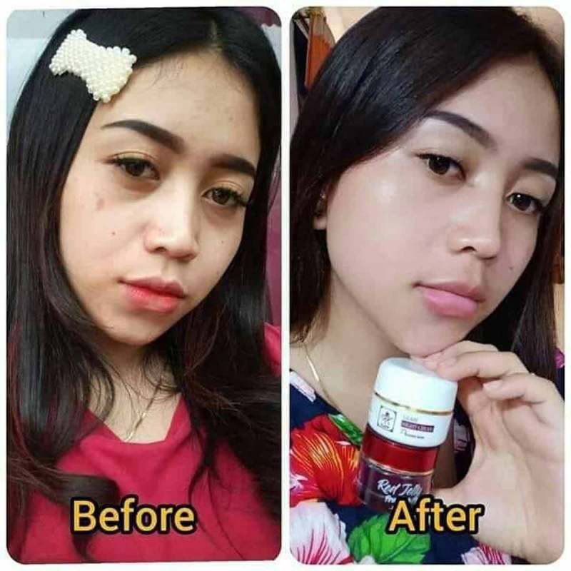 PAKET RK GLOW PREMIUM / CREAM RK GLOW ACNE / CREAM RK GLOW PREMIUM BPOM ORIGINAL 100%