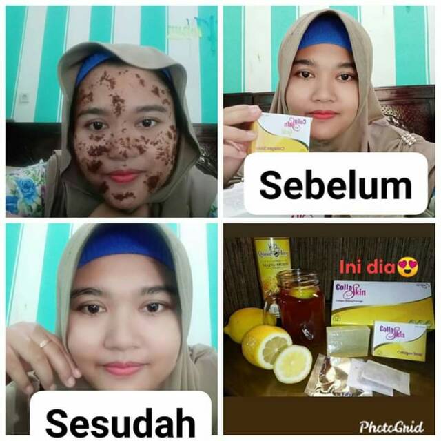 

Collaskin Skin Care NASA