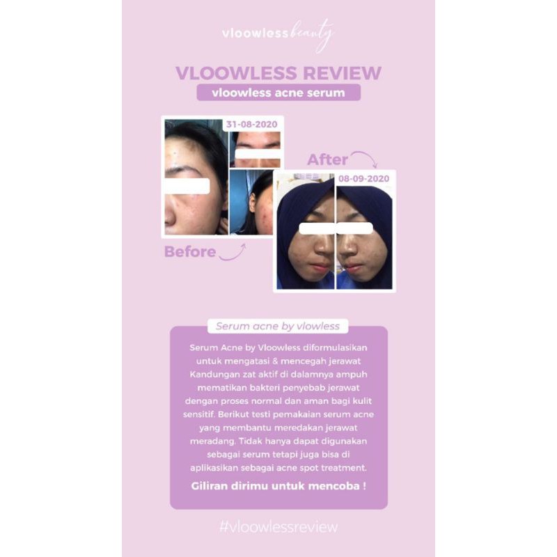 vloowless acne serum
