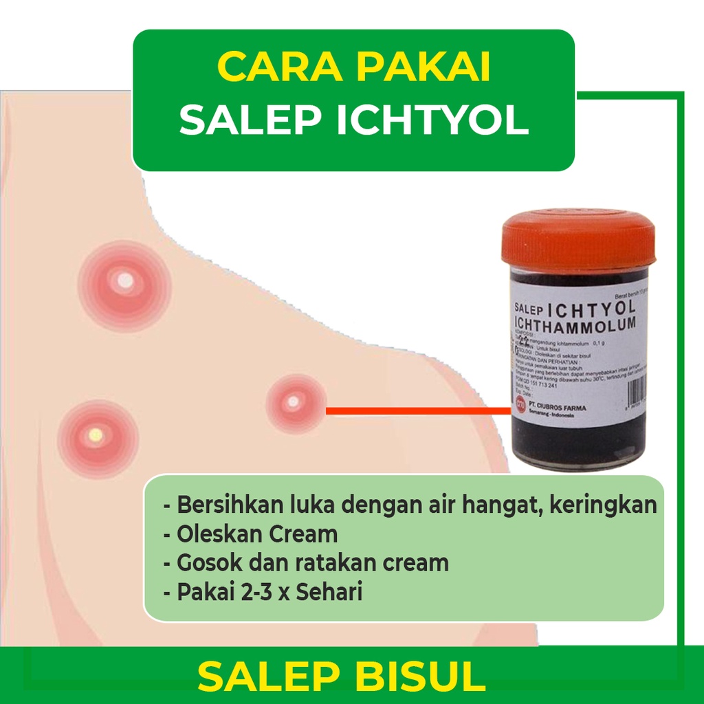 BELI 1 PCS GRATIS 1 SALEP BISUL ICHTYOL - SALEP BPOM HILANGKAN BISUL, ANTIBAKTERIAL, ANTI JAMUR, ANTI PERADANGAN