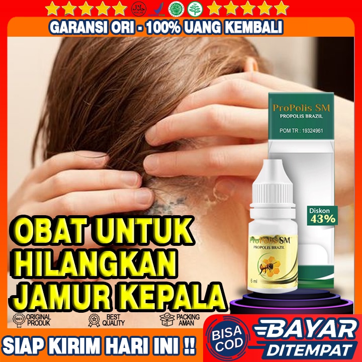 Obat Jamur Di Kepala - Kulit Kepala Berjamur - Kulit Kepala Borok - Ketombe Berlebih - Ketombe Kerin