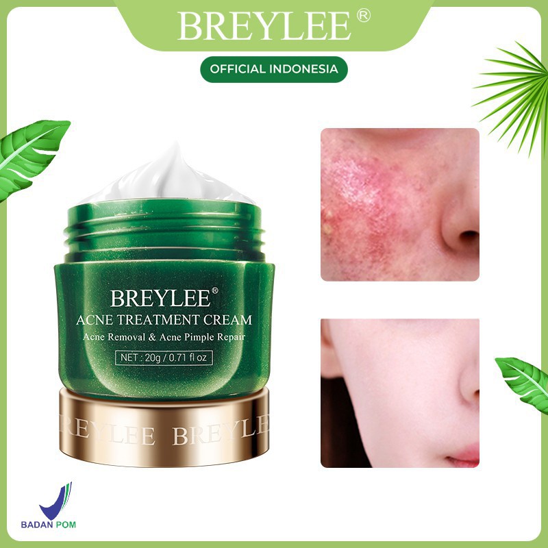 [BPOM] BREYLEE Krim Treatment - Wajah Berjerawat (20g)  Krim Penghilang Jerawat/ Pengecil Pori-pori