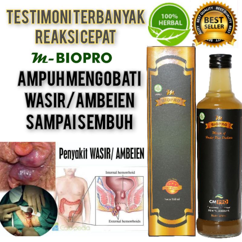Obat Wasir Ampuh l Obat Herbal Wasir l Obat Wasir Ampuh Reaksi Cepat Testimoni Terbanyak