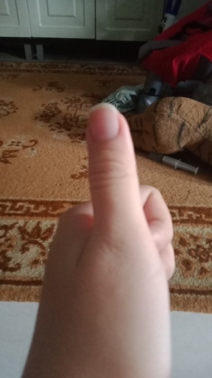 Mitra Loka Container 203 Box Penyimpanan Volume 4l Mercury