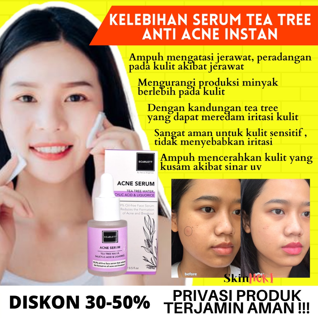 SCARLETT ACNE SERUM TEA TREE WATER 15ML ORIGINAL SERUM PENGHILANG JERAWAT