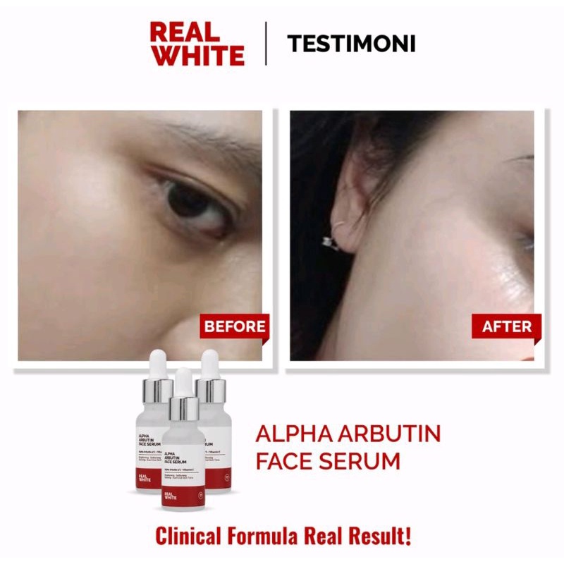 Real white alpha arbutin face serum 20ml