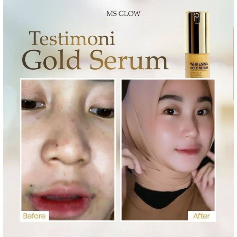 SERUM WHITENING GOLD ORIGINAL MS GLOW (SUDAH BER BARCODE TERBARU)