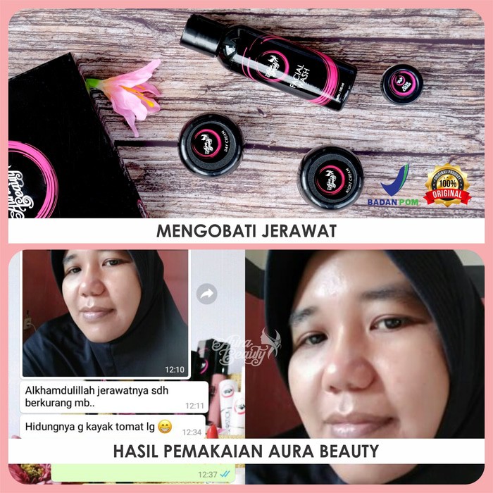 Perawatan Tubuh - Kecantikan - Perawatan Kulit Aura Beauty Acne Complete Sekaligus Pencerah Wajah