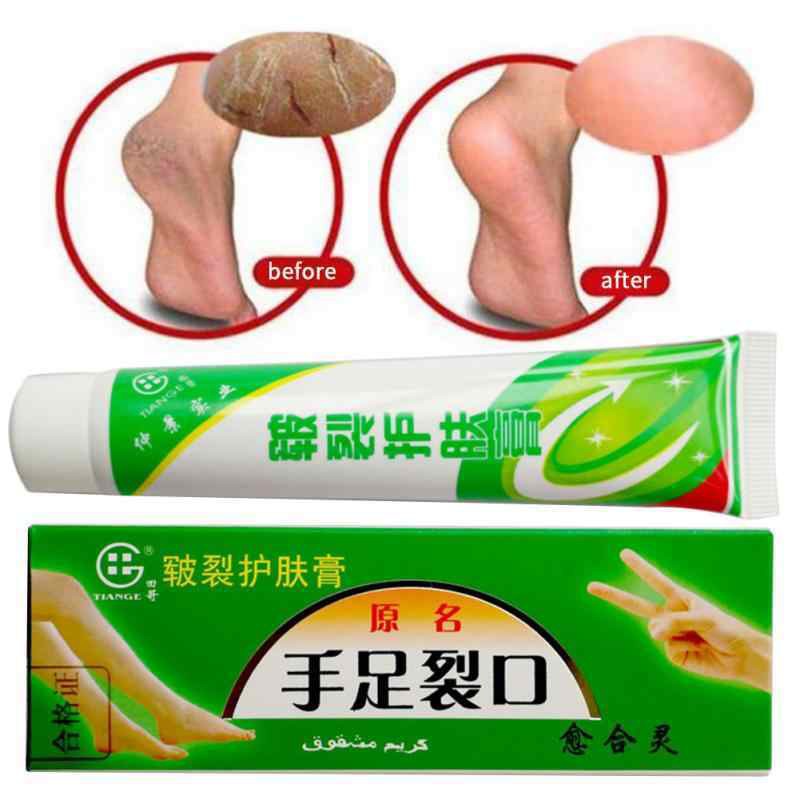 Salep Tumit Pecah Obat Kulit Tangan Kaki Pecah Pecah Kulit Mengelupas Bekas Luka Shopee Indonesia