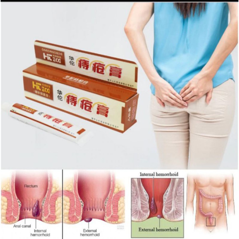 

Salep/Cream Herbal Huatao Ampuh Untuk Wasir Ambeyen Ambeien