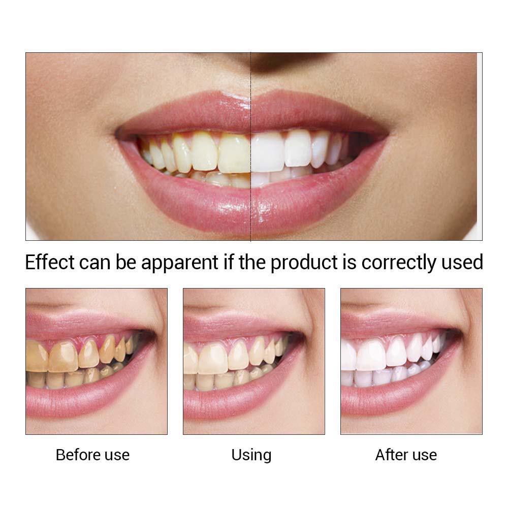 Teeth Whitening Powder Oral Hygiene Cleaning Serum Removes Plaque Stains