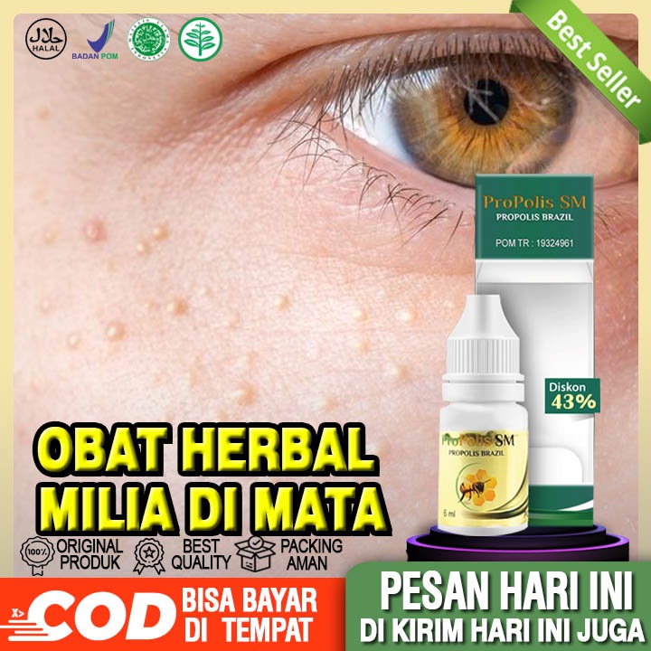 Jual Obat Milia Di Mata Obat Milia Di Bawah Mata Obat Penghilang