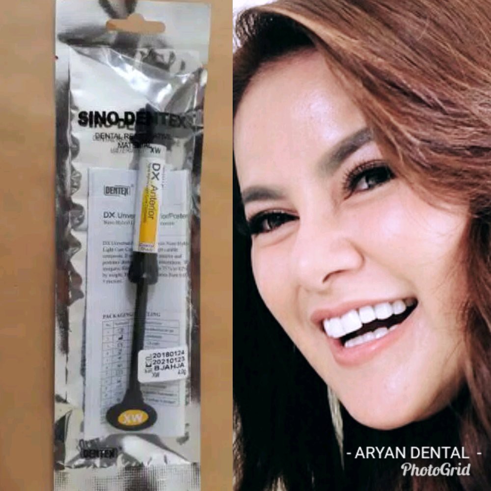 Dental composite veneer  atau dentex xw atau tambalan gigi veneer atau super white