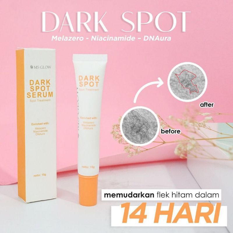 Dark spot serum ms glow