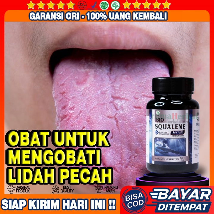 Obat Lidah Pecah Pecah - Obat Lidah Sariawan - Obat Kanker Lidah - Obat Mulut Bengkak - Obat Lidah B
