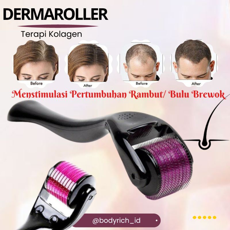 Dermaroller Strechmark Penghilang Bekas Luka Derma Roller Paket Bopeng